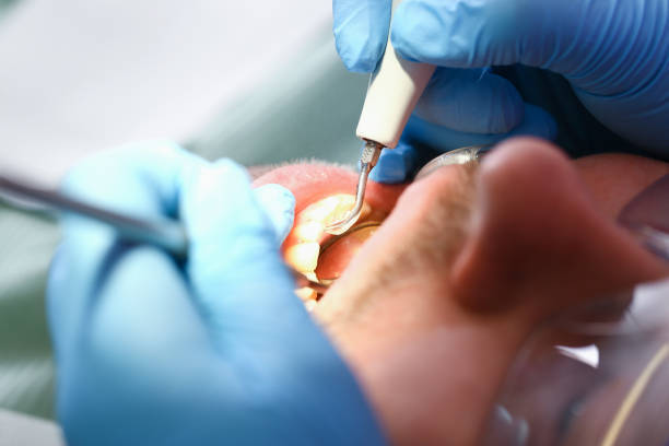 Best Emergency Treatment for Toothache in Maumelle, AR