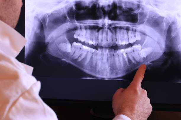 Best Emergency Root Canal Treatment in Maumelle, AR
