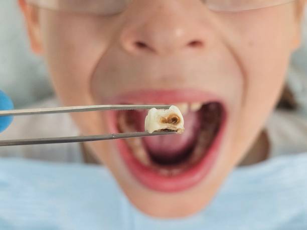 Best Emergency Dental Care for Trauma or Injury in Maumelle, AR