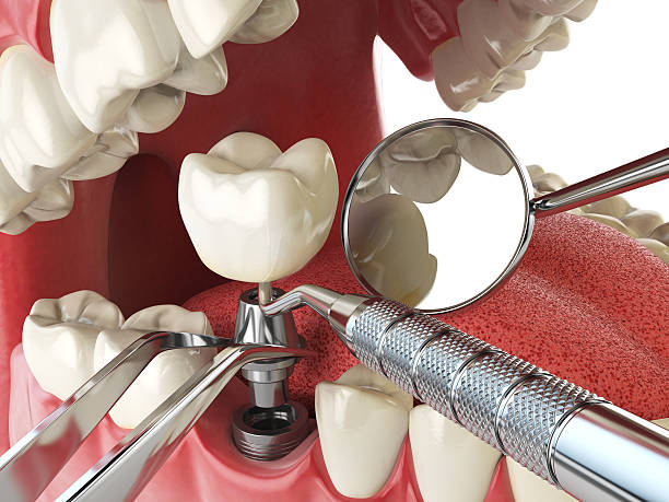 Best Emergency Treatment for Toothache in Maumelle, AR